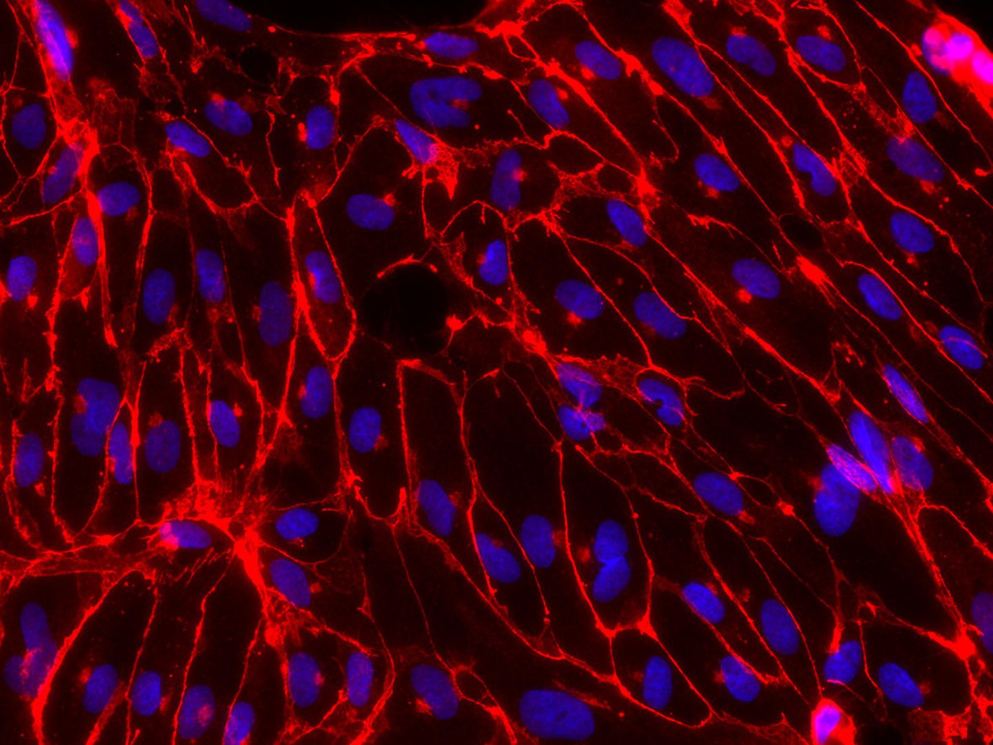 Immunfluoreszenzaufnahme: - In der Kulturschale aus ETV2 iso2 hiPSCs differenzierte Endothelzellen in rot. Die Zellkerne sind blau.