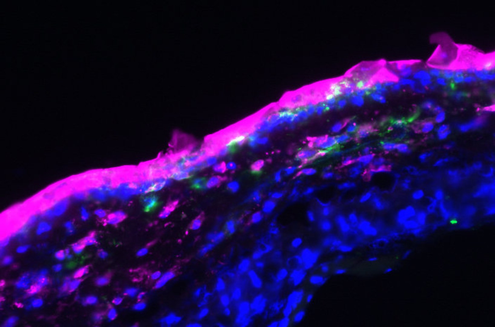 Fluoreszenzmikroskopische Aufnahme der mit Aptamercreme behandelten Haut: - Die Aptamere (hier pink markiert) wurden in Form einer Salbe auf die oberste Hautschicht aufgetragen und drangen auch in tiefere Hautschichten ein (Zellkerne: blau; Antigen-präsentierende Zellen: grün).