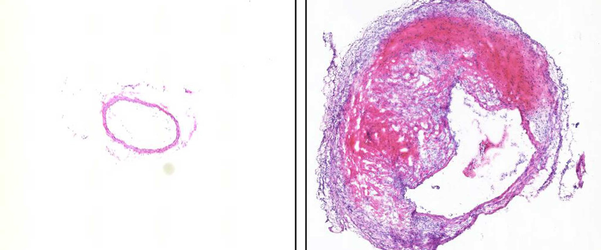 Hämatoxylin- und Eosin-Färbung von Querschnitten der Bauchaorta aus der Maus